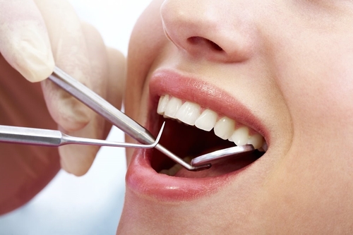 Tẩy trắng răng giá bao nhiêu tiền 1
