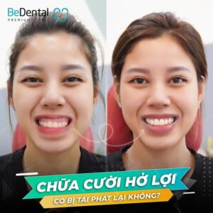 cuoi ho loi co tai phat khong