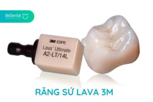 răng sứ lava 3m